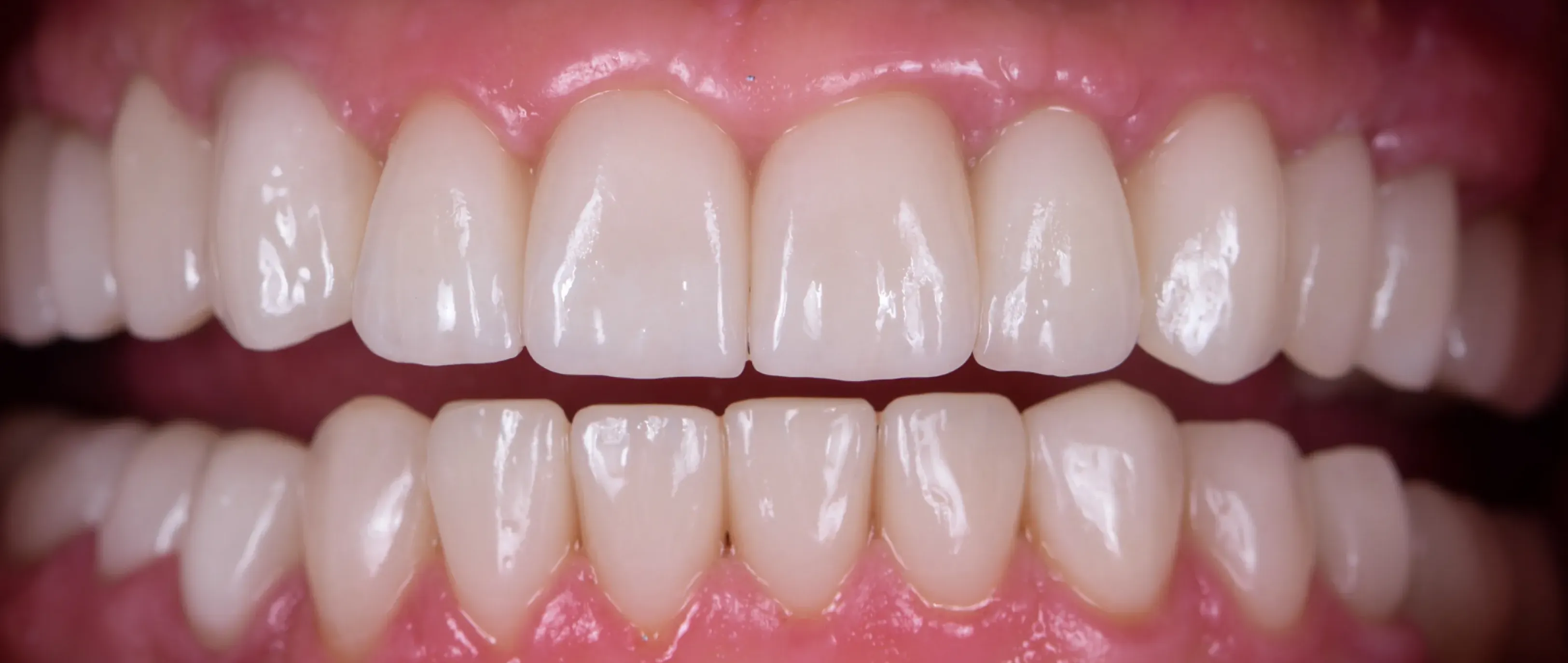 After dental treatment